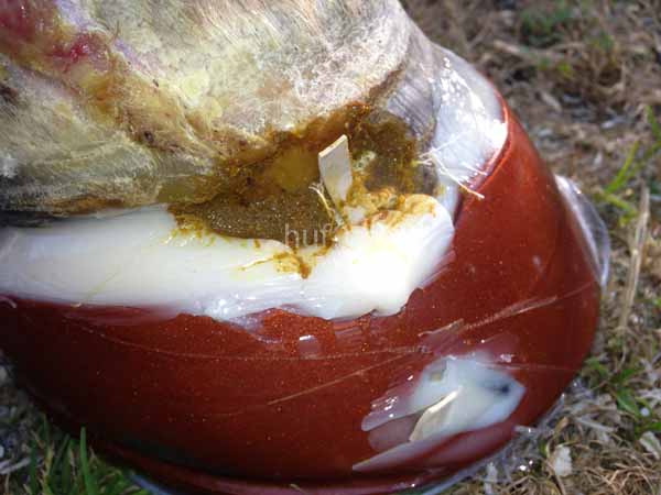 abzesslfistel-klebebeschlag001